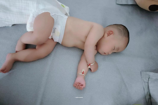 辽源六个月宝宝眼睛散光